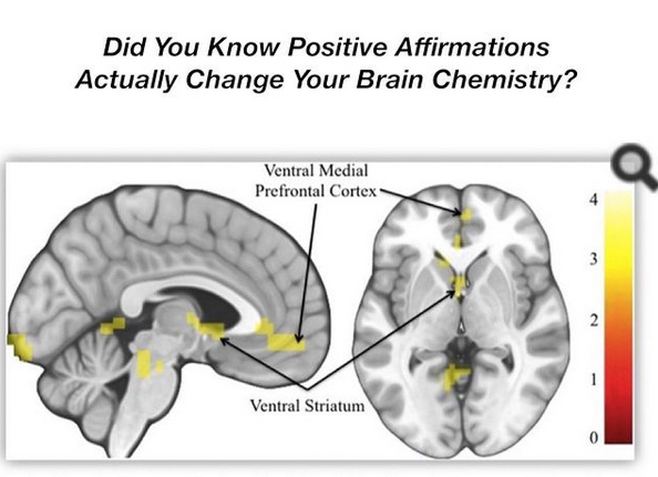 Let’s Talk About … Brain Chemistry