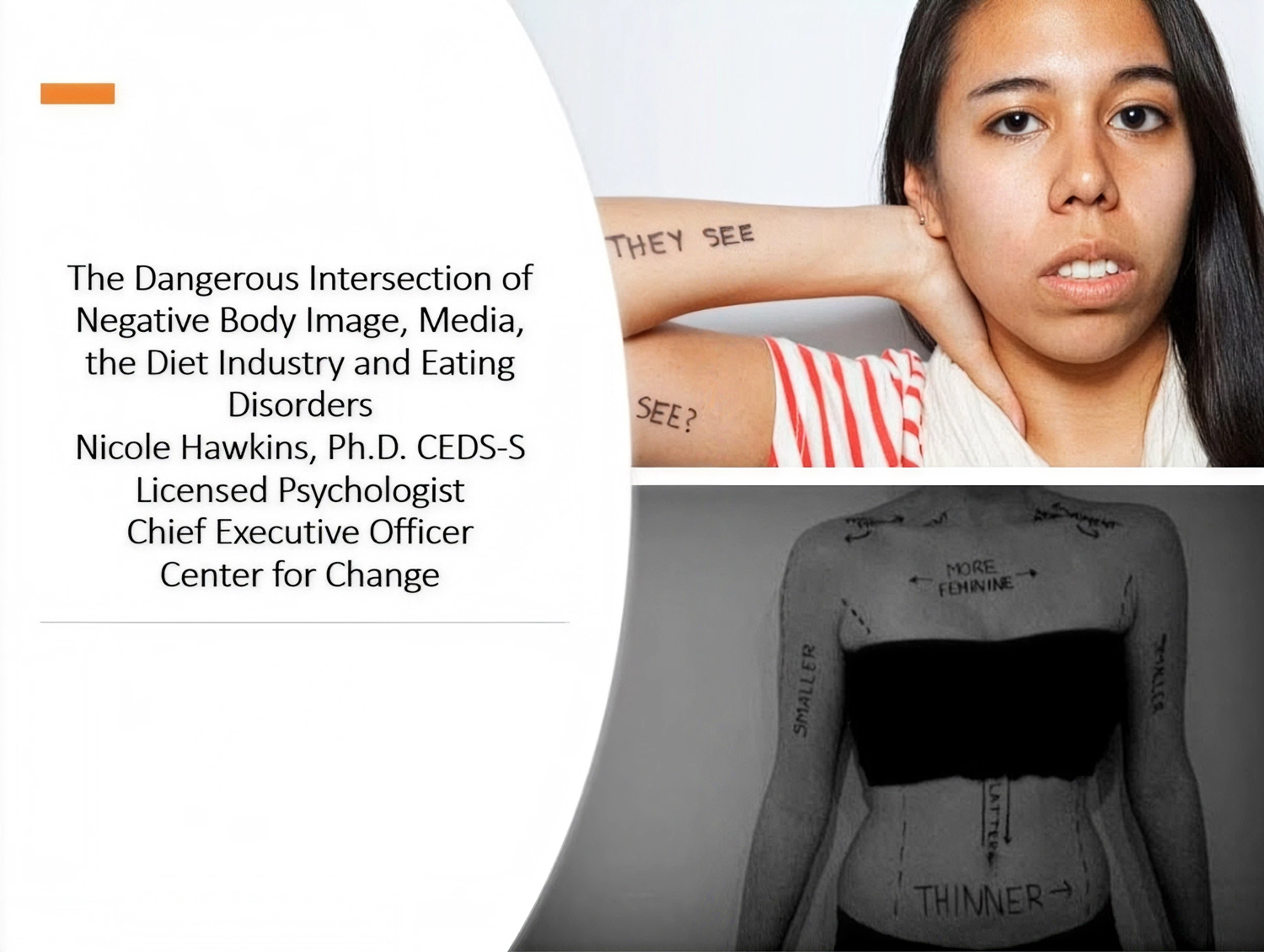 The Dangerous Intersection of Body Image, Social Media, the Diet Industry, and Eating Disorders